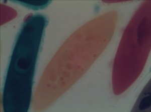 Paramecium taken by AxioVision at Low Light Condition