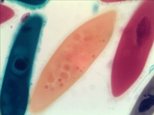 Paramecium taken by AxioVision with Best Fit at Normal Light Condition