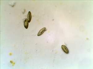 Daylily Pollen at 100X