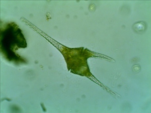 A Dinoflagellate Ceratium spp.